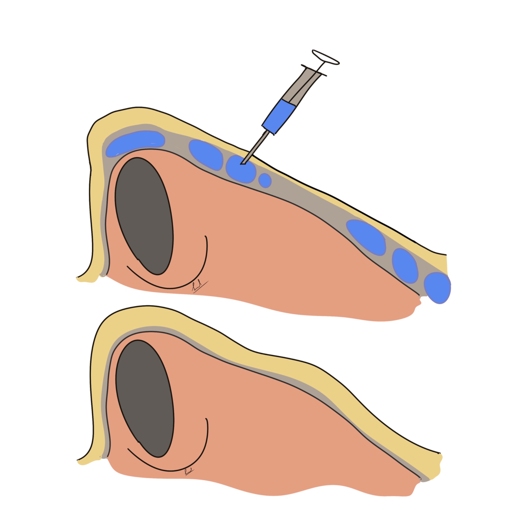 Anti-Ageing illustration — Dr. Sinnet Roy